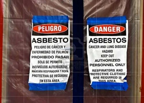 Asbestosis